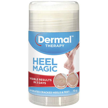 Dermal Therapy Heel Magic 70g